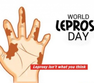 World Leprosy Day- January 30