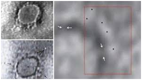 Indian scientists reveal first microscopic image of novel coronavirus